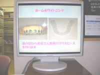 デジタルレントゲン