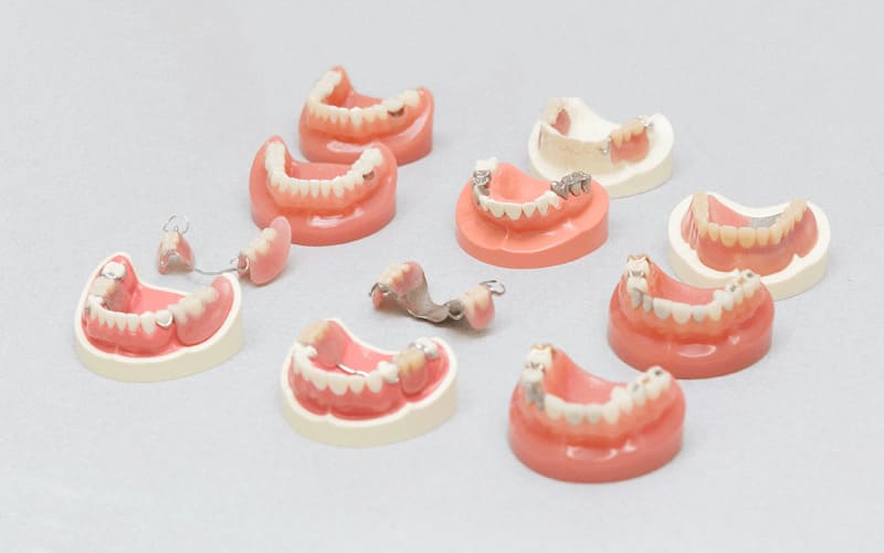 精密入れ歯へのこだわり・治療の流れ