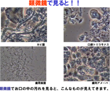 位相差顕微鏡で口の中の細菌の状態